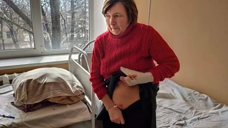 Внаслідок обстрілу військами РФ Марїнки поранено жінку, яка перебувала на автобусній зупинці, - гуманітарна місія Проліска 02