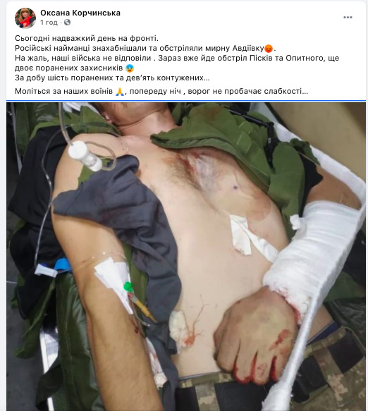 В результате российских обстрелов 28 августа шесть бойцов ВСУ ранены, девять - контужены, - Корчинская 01