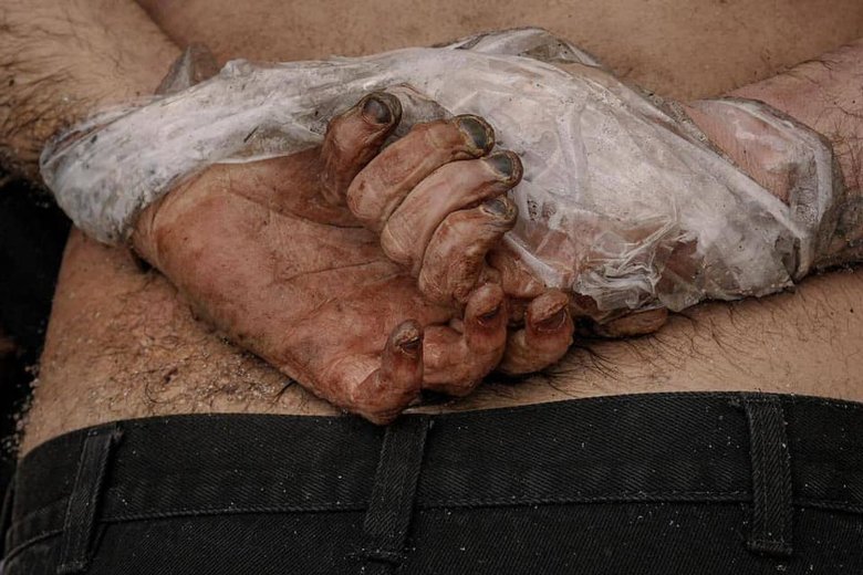 Сліди тортур, тіла зі звязаними руками та спроби приховати злочини: звірства росіян у Бучі 08